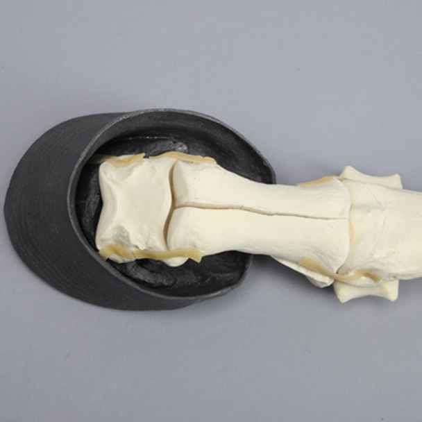 Equine Encased Distal Thoracic Limb with Phalanx Fracture