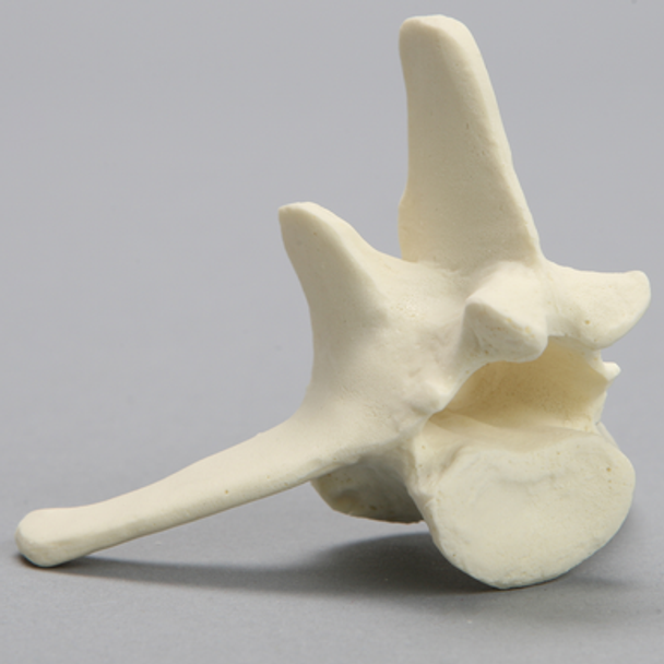 Canine Vertebra, L5, Solid Foam