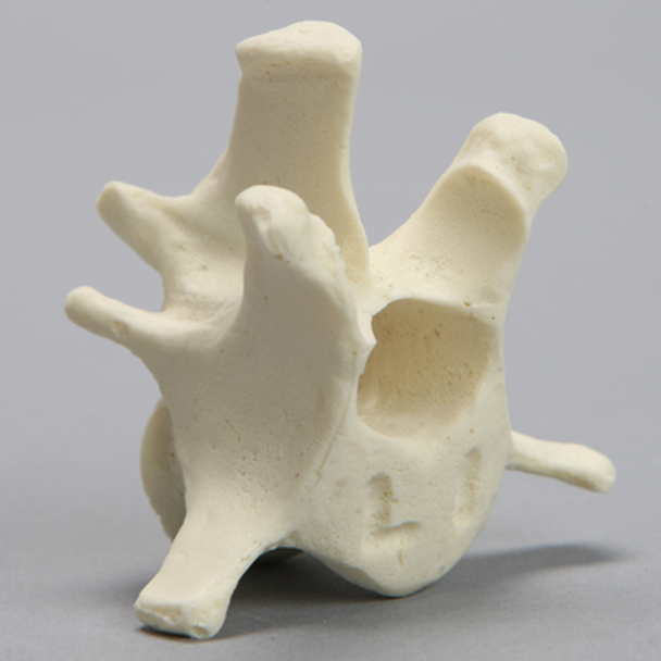 Canine Vertebra, L1, Solid Foam