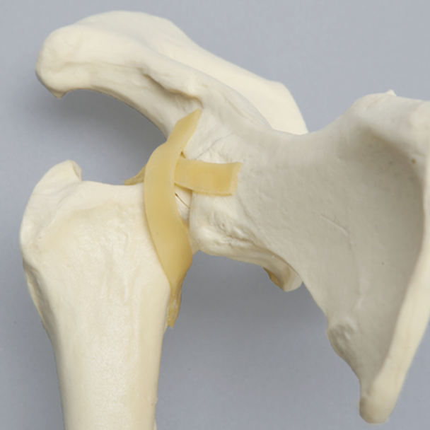 Canine Hemi Pelvis with Fractured Femur