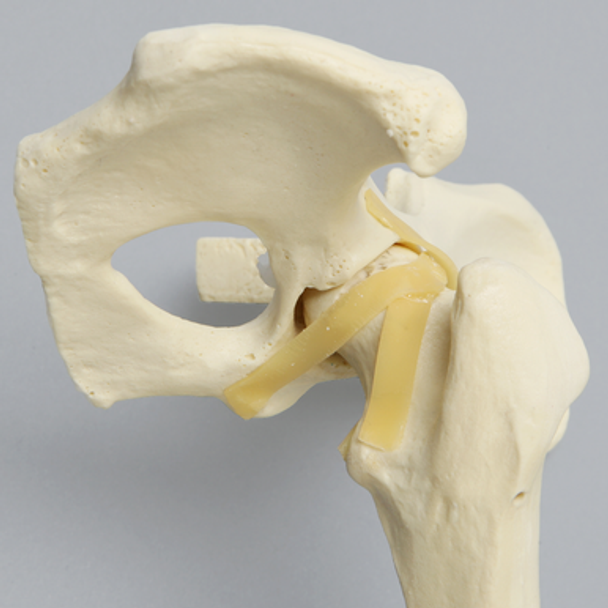 Canine Hemi Pelvis with Fractured Femur