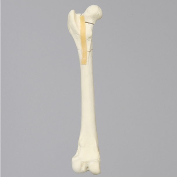 Canine Femur with Four-Part Comminuted Fracture
