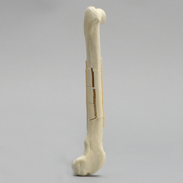 Canine Toy Breed Femur with Comminuted Midshaft Fracture