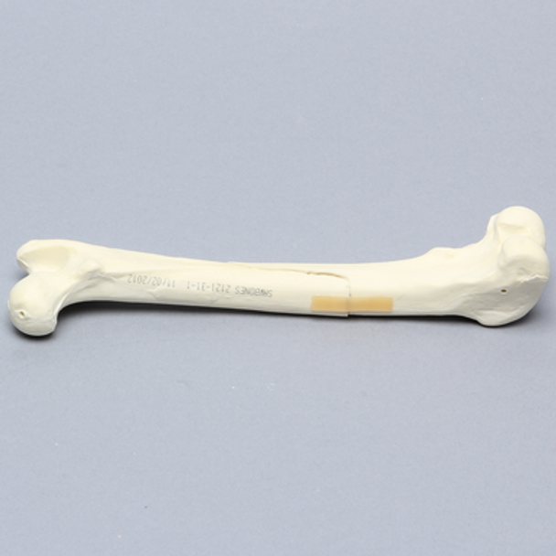 Canine Femur with Spiral Fracture