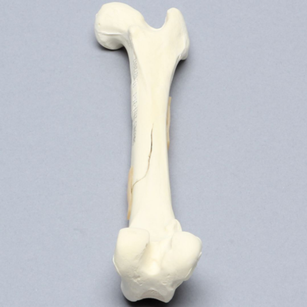 Canine Femur with Spiral Fracture