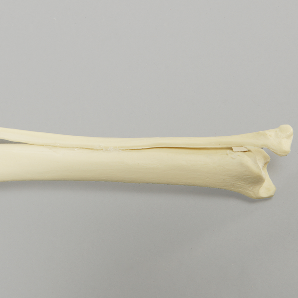 Canine Tibia/Fibula