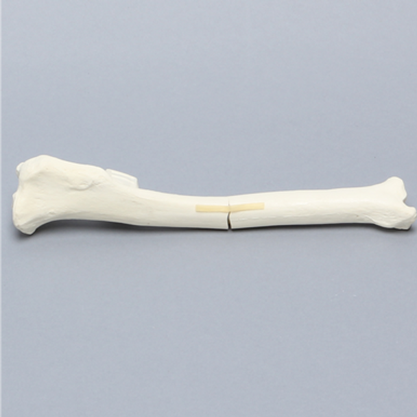 Canine Tibia with Transverse Midshaft Fracture, With Vise Attachment, Left