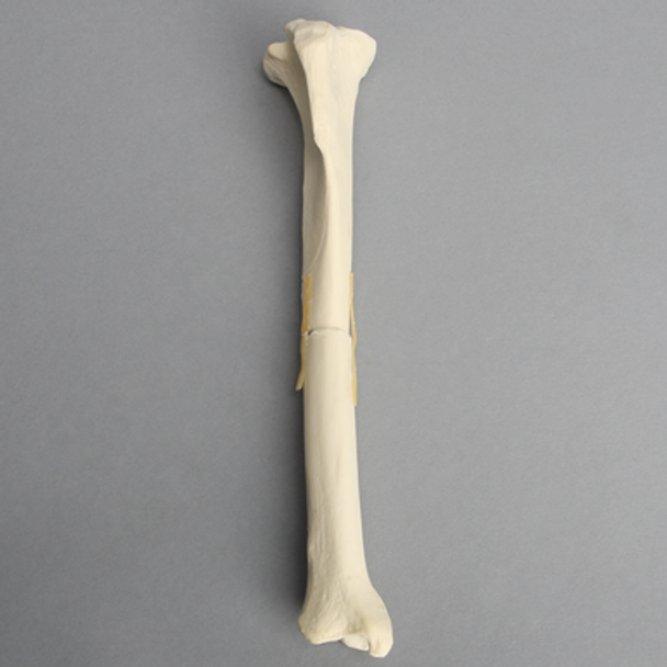 Canine Tibia with Transverse Fracture