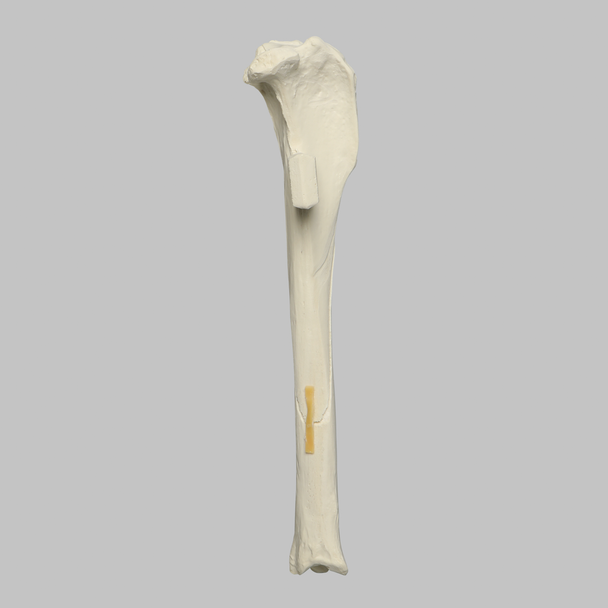 Canine Tibia with Long Oblique Midshaft Fracture, With Vise Attachment