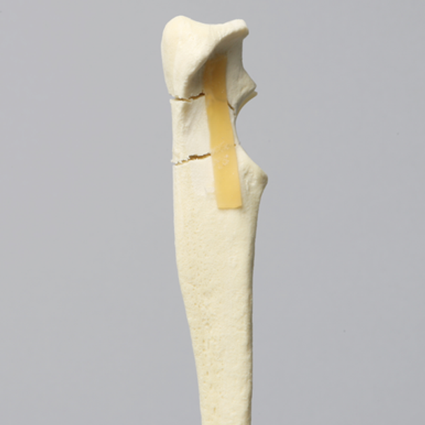 Canine Ulna with Three-Part Olecranon Fracture, Solid Foam