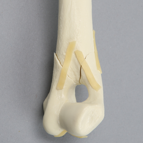 Canine Humerus with Distal "Y" Fracture, Foam Cortical, Left