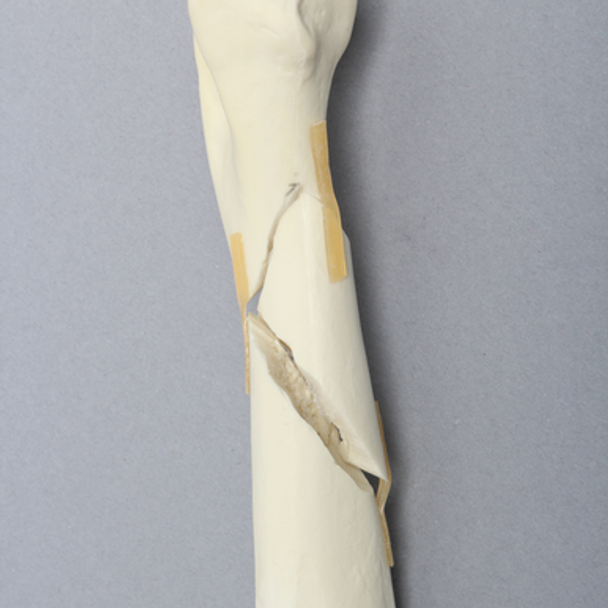 Canine Humerus, Foam Cortical, Small