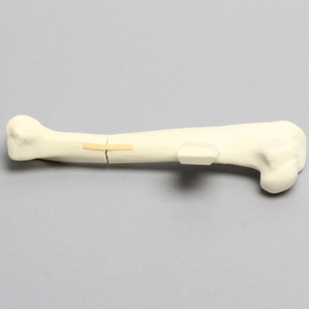 Canine Humerus with Distal Third Transverse Shaft Fracture, Solid Foam