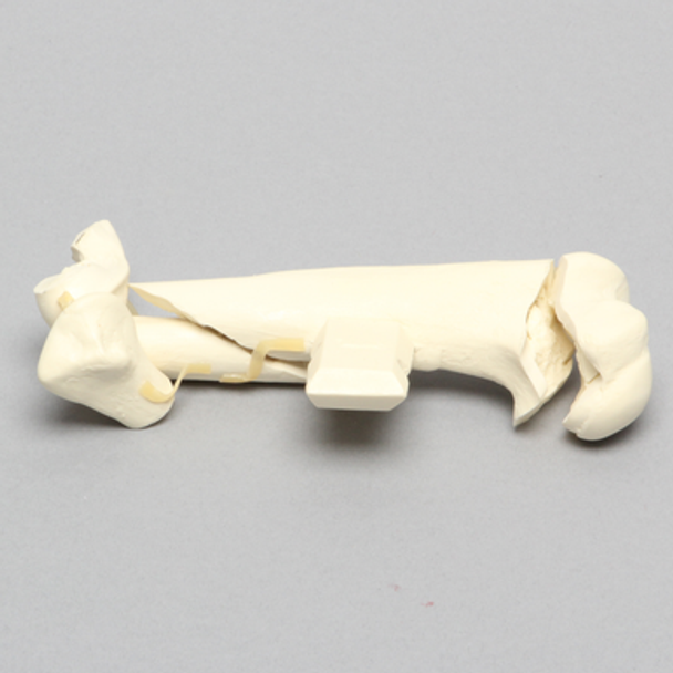 Canine Humerus with Multiple Fractures, Foam Cortical
