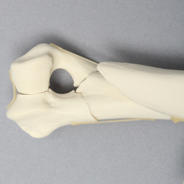 Canine Humerus with Multiple Fractures, Foam Cortical