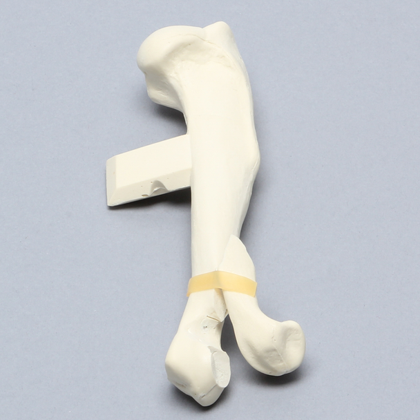 Canine Humerus with Distal Condylar Fracture, Foam Cortical
