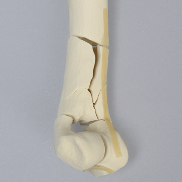 Canine Humerus with Fracture, Enlarged, Solid Foam