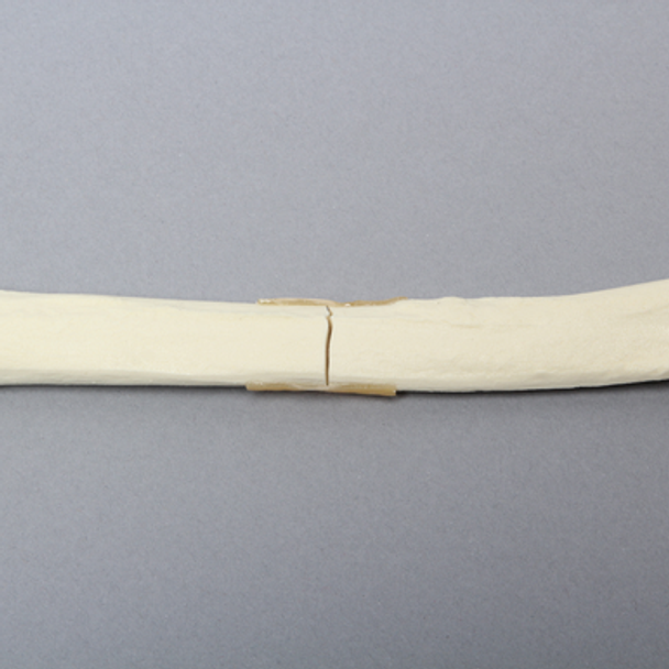 Canine Radius with Midshaft Transverse Fracture, Solid Foam, Left