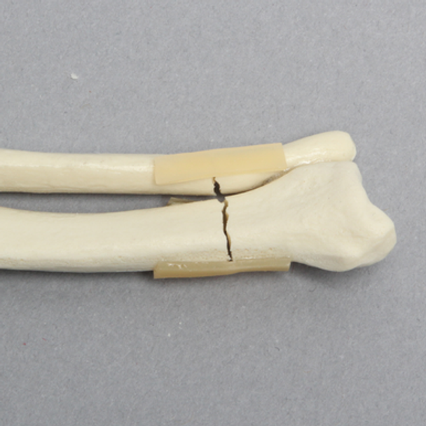 Canine Radius and Ulna with Distal Transverse Fractures, Solid Foam, Small
