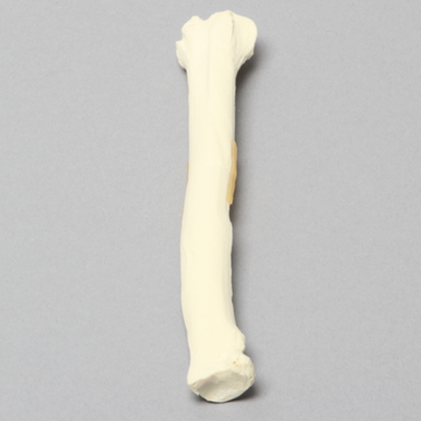 Canine Radius with Midshaft Transverse Fracture, Solid Foam, Right