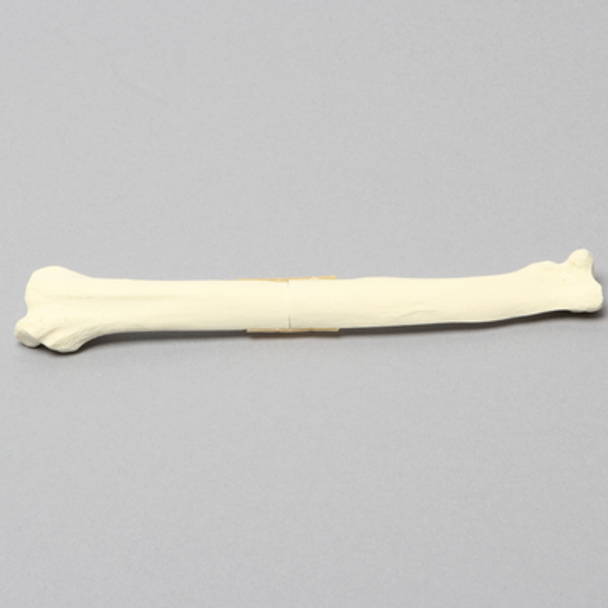 Canine Radius with Midshaft Transverse Fracture, Solid Foam, Right