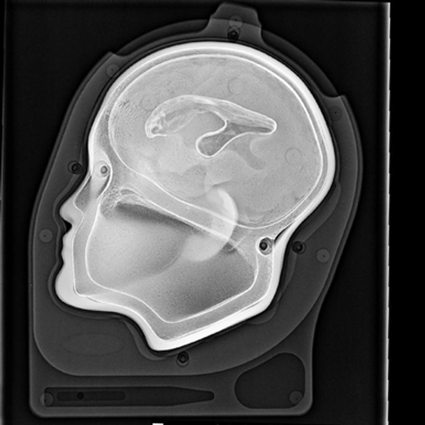 Cranial Access Fluoroscopy Model