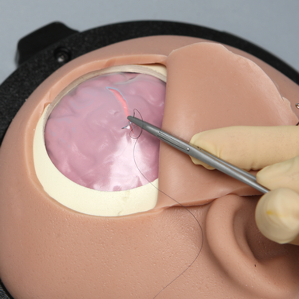 Standard Cranial Access Model