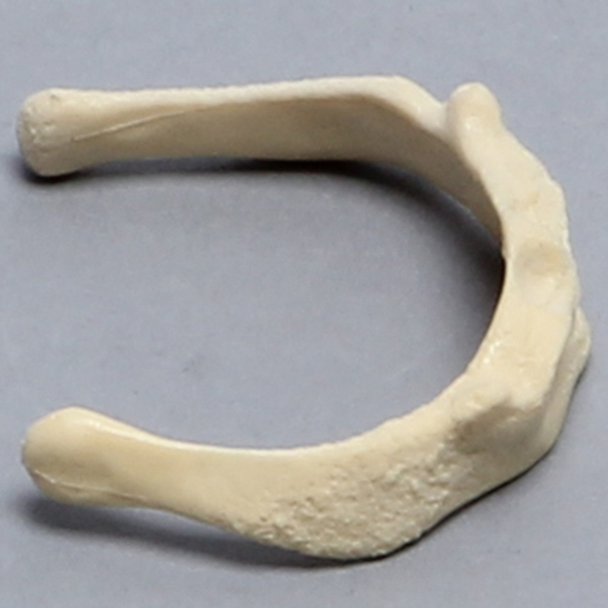 Hyoid Bone, Component of Palate/Tongue Complex