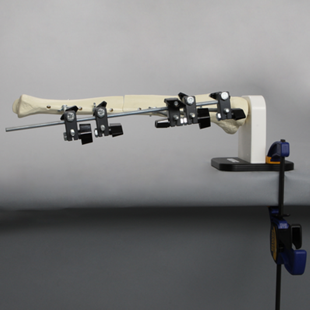 Orthopaedics in Action® Engineering an Ex-Fix Module