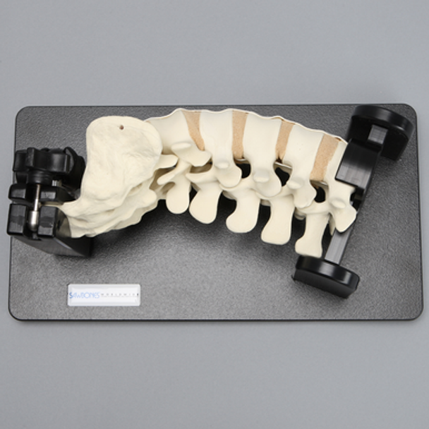 Lateral Lumbar Holder with Spine