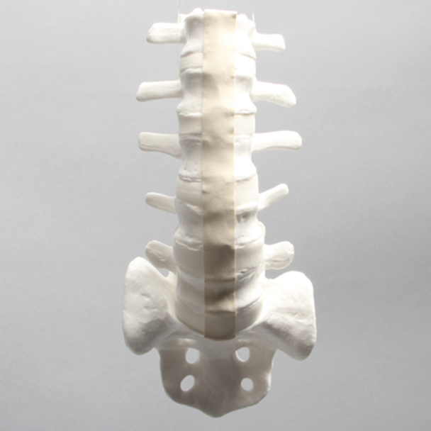 Lumbar Vertebrae with Pedicle Tunnels, L1-Sacrum