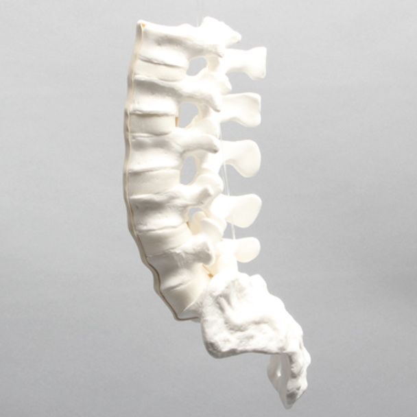 Lumbar Vertebrae with Pedicle Tunnels, L1-Sacrum
