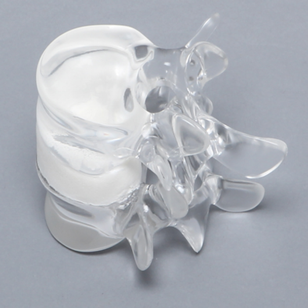 Lumbar Vertebrae L4 - L5 with White Foam Disc, Solid Clear Plastic