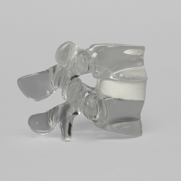 Lumbar Vertebrae L4 - L5 with White Foam Disc, Solid Clear Plastic