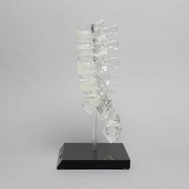 Spine with Clear Discs, Lumbar, Solid Clear Plastic