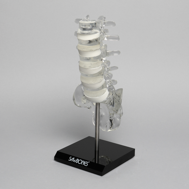 Spine with White Foam Discs, Lumbar, Solid Clear Plastic