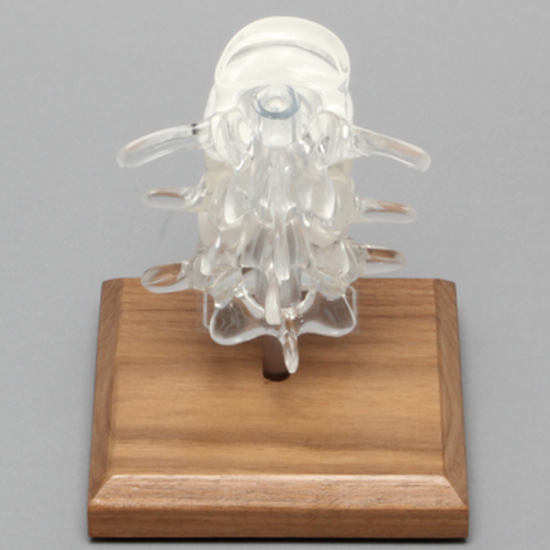 Lumbar Vertebrae L3 - L5, Solid Clear Plastic