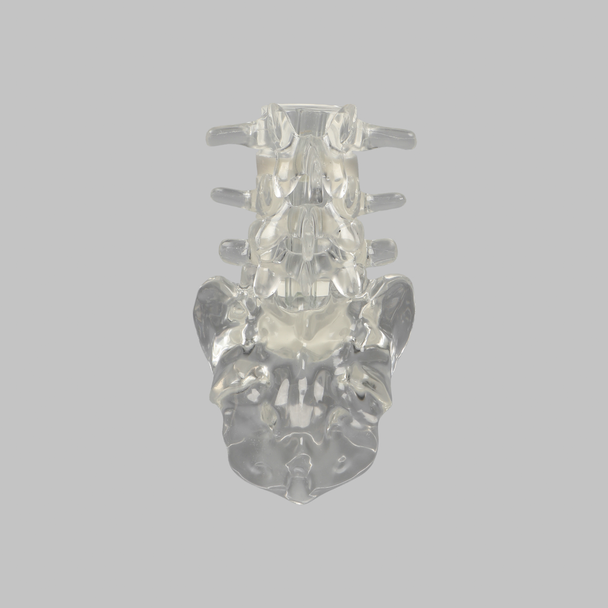 Lumbar Vertebrae L3-Sacrum with White Foam Discs, Solid Clear Plastic