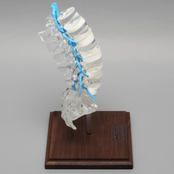 Spine with Nerve Roots, Lumbar, Solid Clear Plastic
