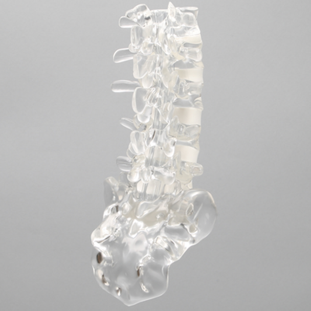 Spine, Lumbar, Solid Clear Plastic