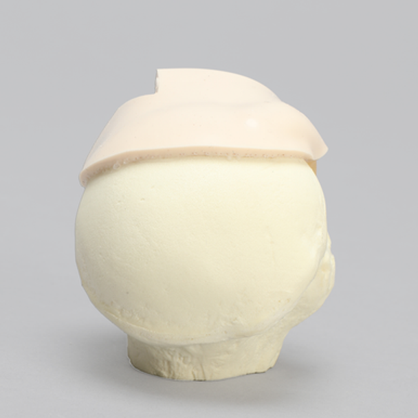 MagneFAST Humeral Head Insert