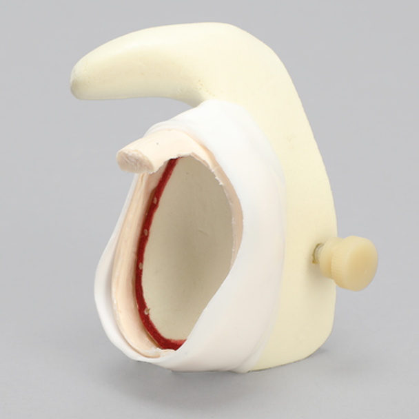 MagneFAST Glenoid Insert