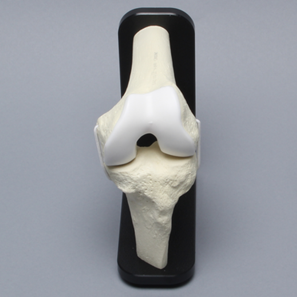 Knee Joint with Articular Cartilage and Stand
