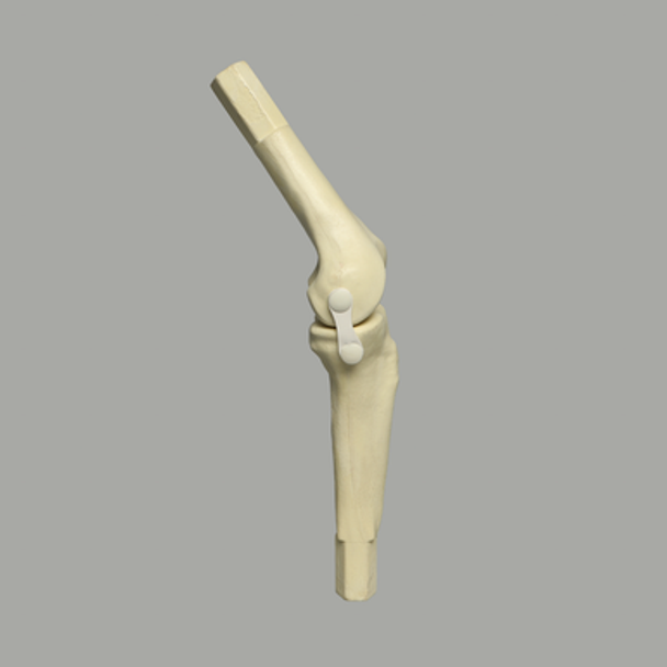 Converge™ Large Knee Joint with Non-Stretch Ligaments