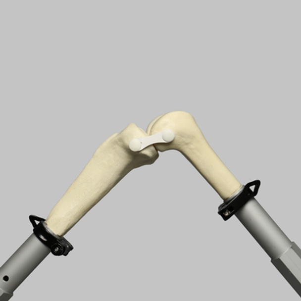 Converge™ Large Knee Joint with Non-Stretch Ligaments