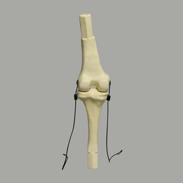 Converge™ Large Knee Joint with Adjustable Ligaments