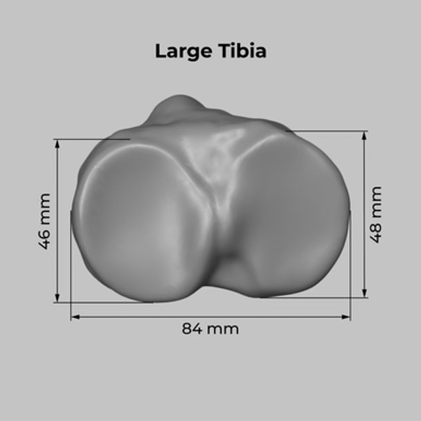 Converge™ Large Knee Joint with Adjustable Ligaments
