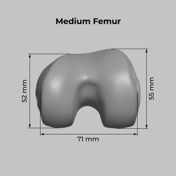 Converge™ Medium Knee Joint with Adjustable Ligaments