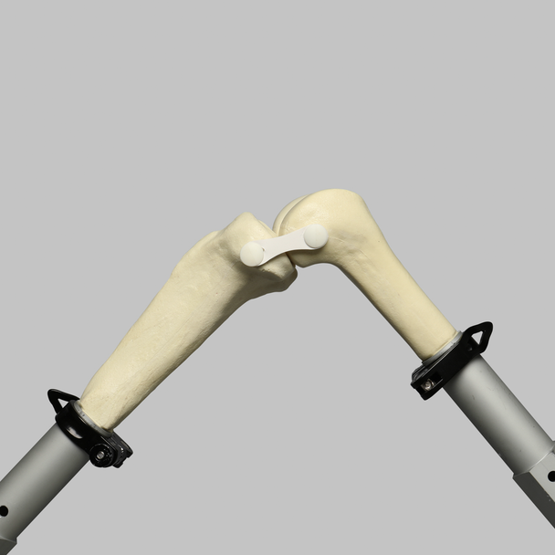 Converge™ Knee System - Table Mounted Converge™ Knee System - Table Mounted