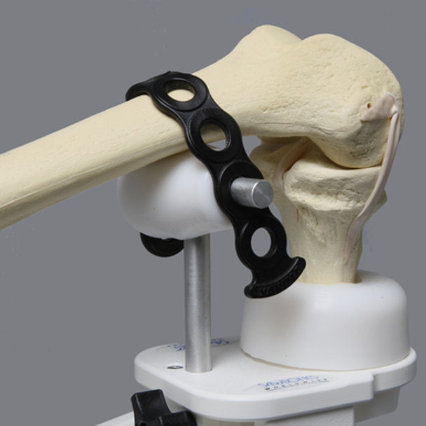 Express Knee Holder